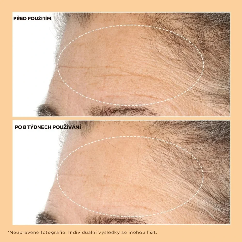 Perricone MD DEEP CREASE SERUM NEUROPEPTIDY na hlboké vrásky