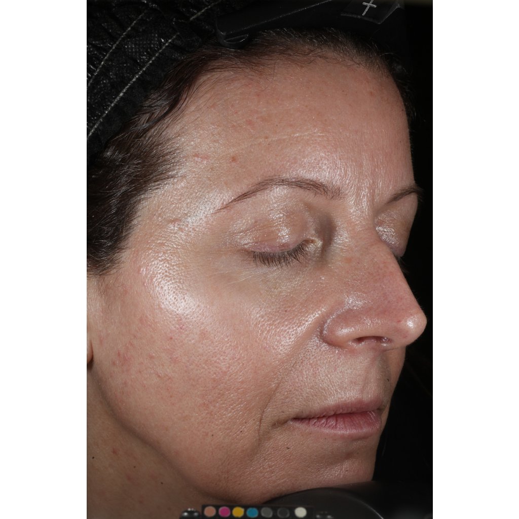 Perricone MD Cold Plasma Plus+ sérum na tvár