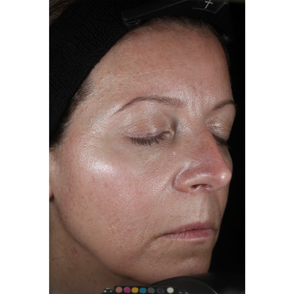 Perricone MD Cold Plasma Plus+ sérum na tvár