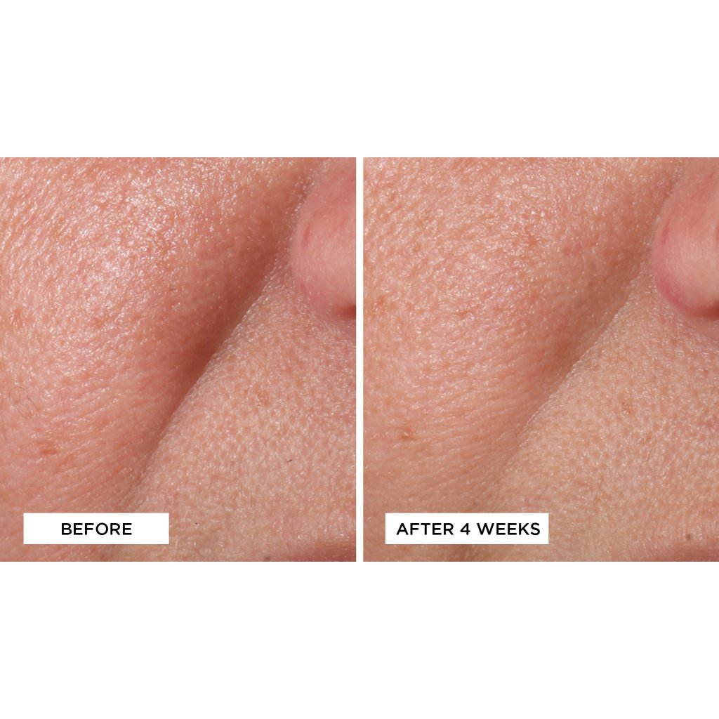 Perricone MD Cold Plasma Plus+ sérum na tvár