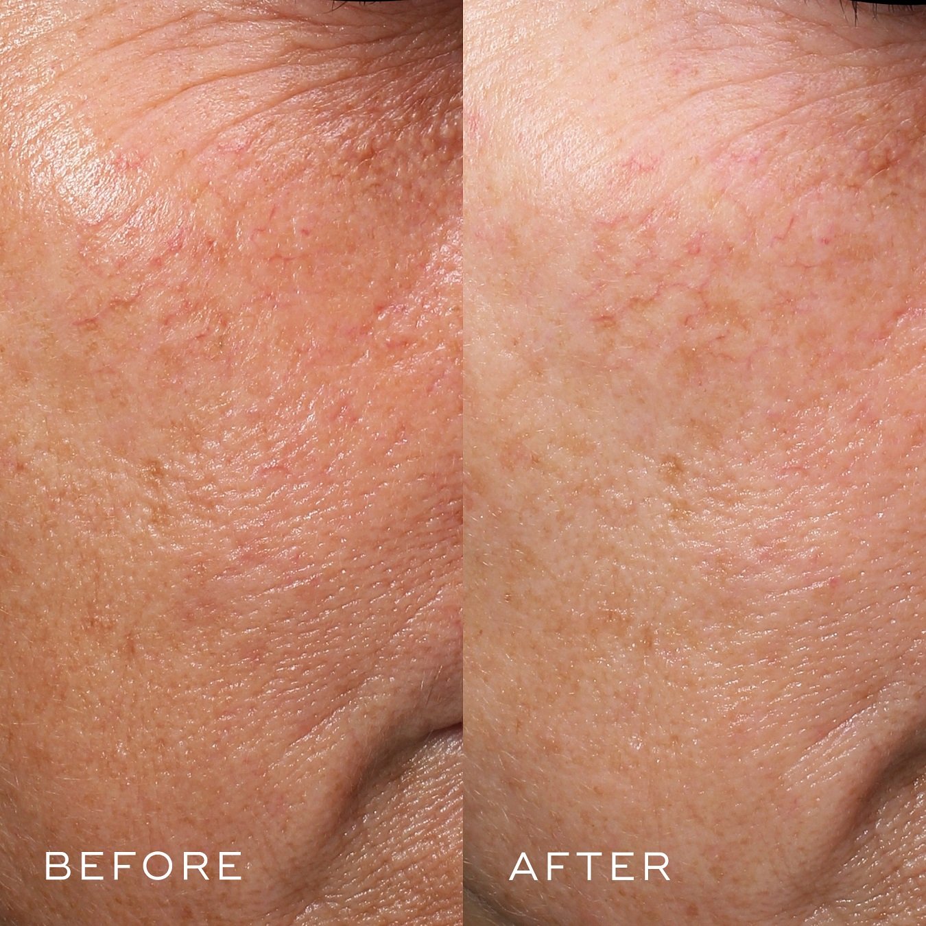 Medik8 Crystal Retinal 10 - retinol sérum