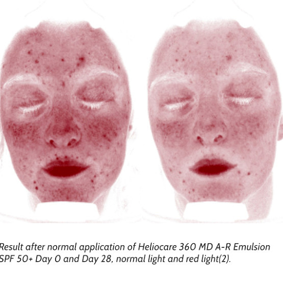 HELIOCARE 360º MD A-R Emulsion SPF 50+