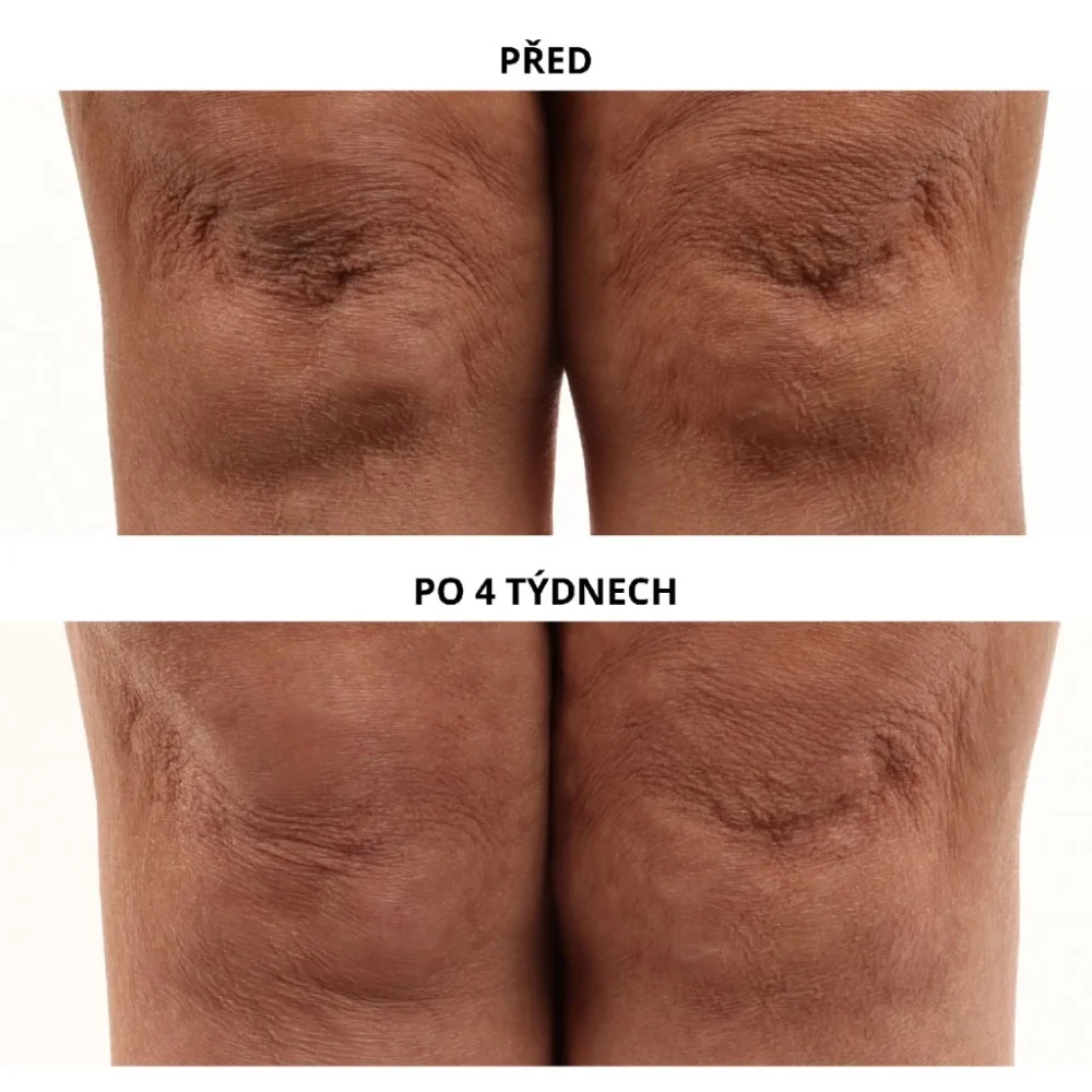 Essential Fx Acyl-Glutathione Chia olej na telo