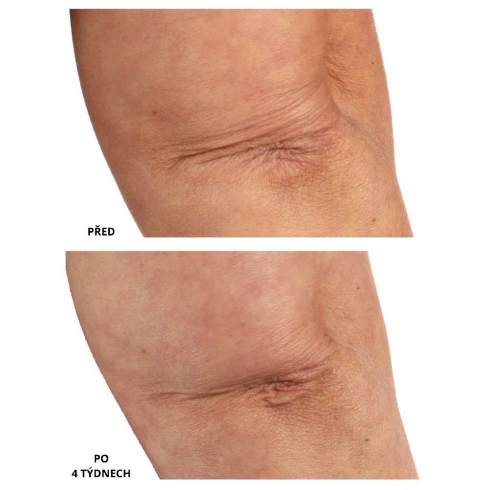 Essential Fx Acyl-Glutathione Chia olej na telo