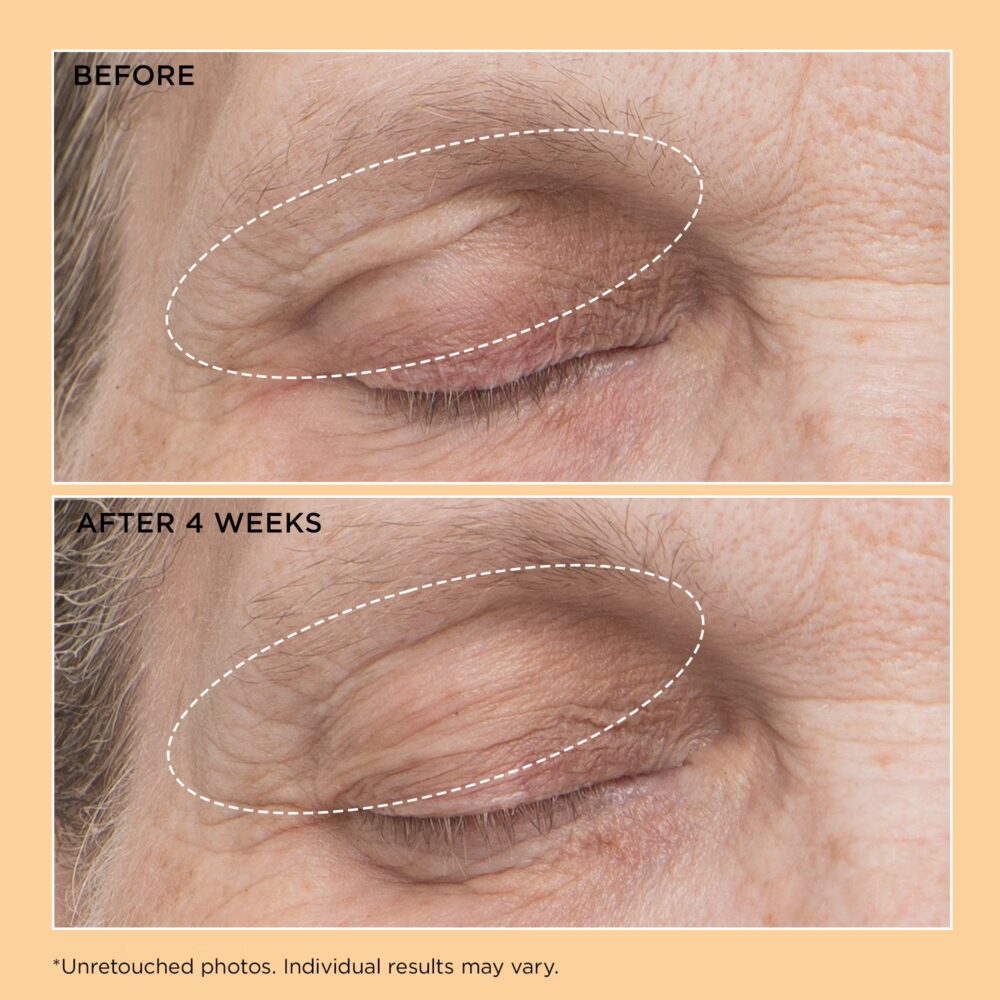 Neuropeptide Liftingové očné sérum, 15 ml