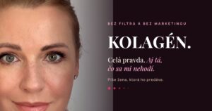 Iveta Štecová, celá pravda o kolagéne bez marketingu